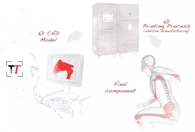 骨科3D打?。汗怩r外衣掩蓋下的骨感賽道